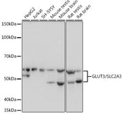 GLUT3/SLC2A3 Rabbit mAb