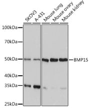 BMP15 Rabbit mAb