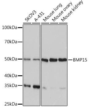 BMP15 Rabbit mAb