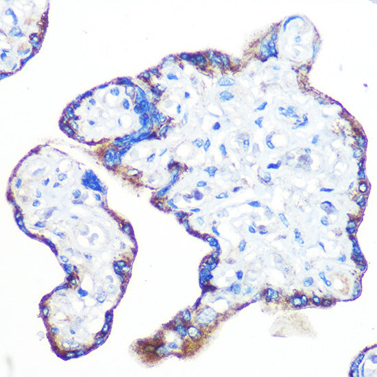 Epac1/RAPGEF3 Rabbit mAb