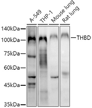 CD141/Thrombomodulin Rabbit pAb
