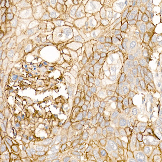 CD141/Thrombomodulin Rabbit pAb
