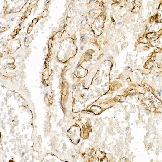 CD141/Thrombomodulin Rabbit pAb