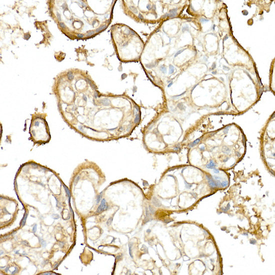 CD141/Thrombomodulin Rabbit pAb