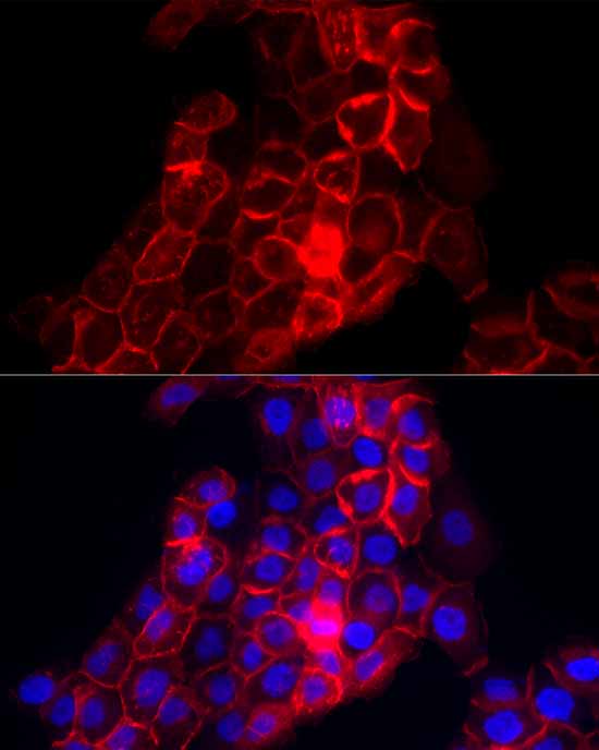 CD141/Thrombomodulin Rabbit pAb