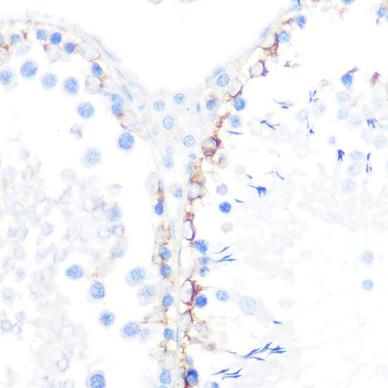 γ-Catenin Rabbit mAb
