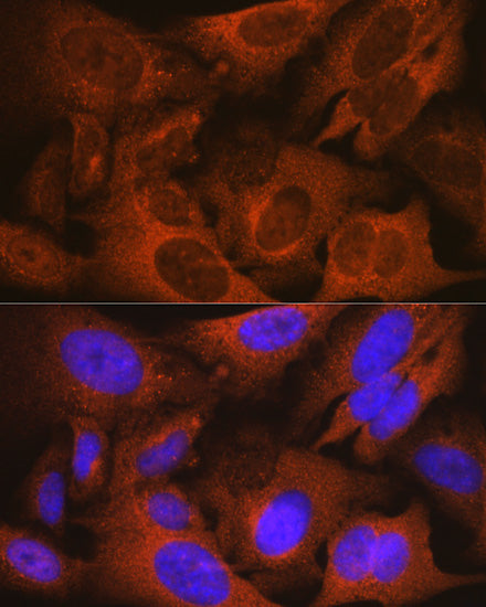 MSMB Rabbit mAb
