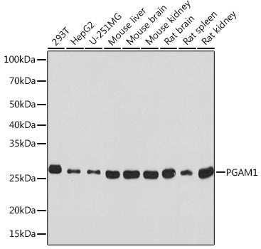 PGAM1 Rabbit mAb