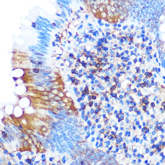 PGAM1 Rabbit mAb