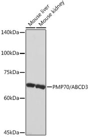 PMP70/ABCD3 Rabbit mAb