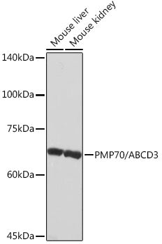 PMP70/ABCD3 Rabbit mAb