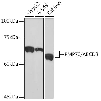 PMP70/ABCD3 Rabbit mAb
