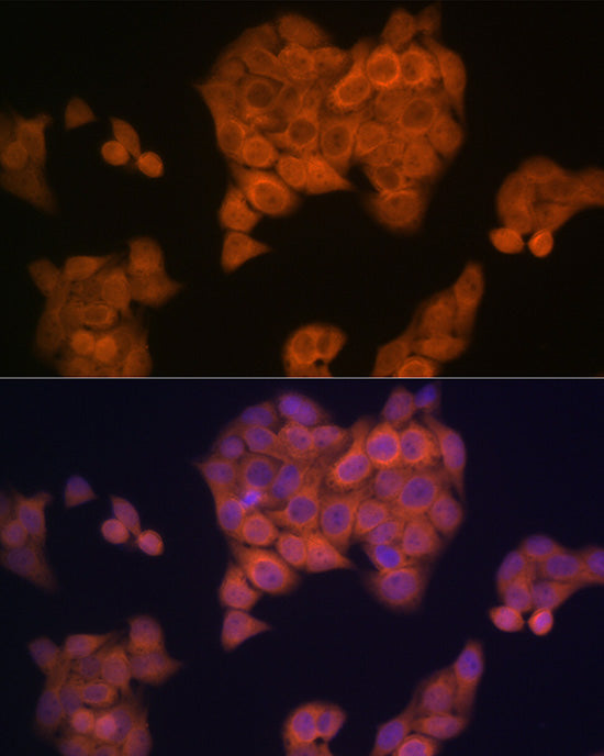 PMP70/ABCD3 Rabbit mAb