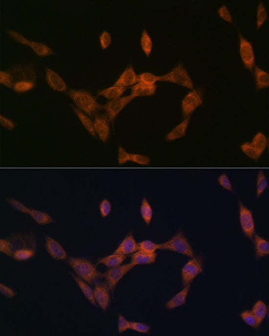 PMP70/ABCD3 Rabbit mAb