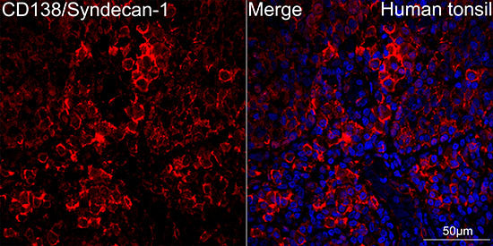 CD138/Syndecan-1 Rabbit mAb