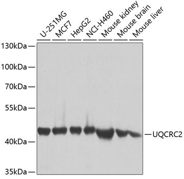 UQCRC2 Rabbit pAb