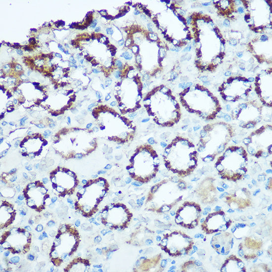 UQCRC2 Rabbit pAb