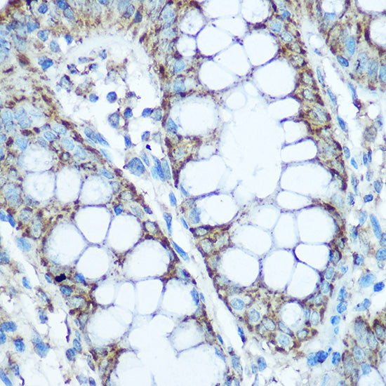 UQCRC2 Rabbit pAb