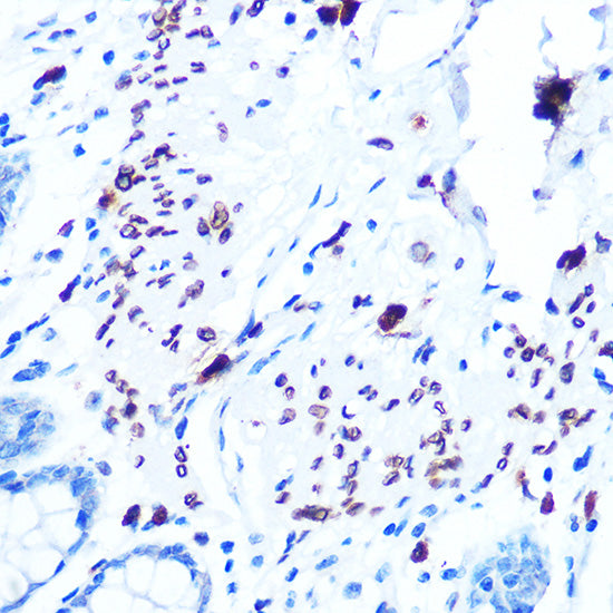 Emerin/EMD Rabbit mAb