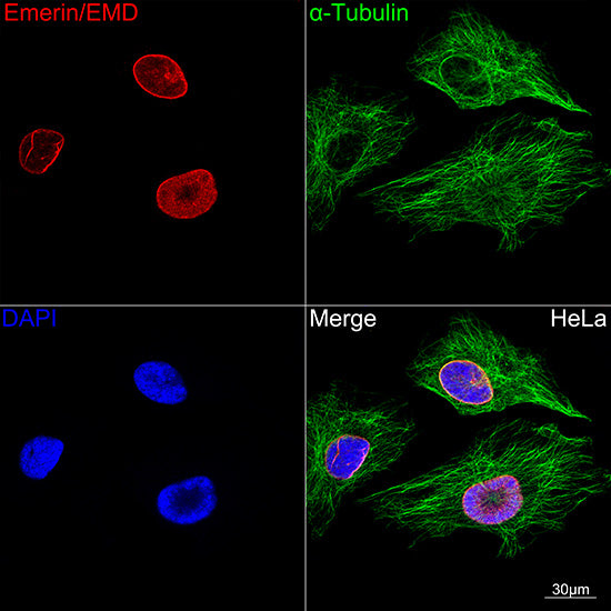 Emerin/EMD Rabbit mAb