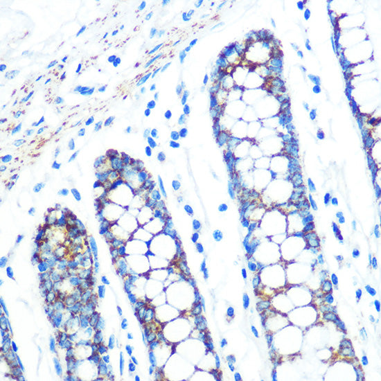 SFRP4 Rabbit mAb