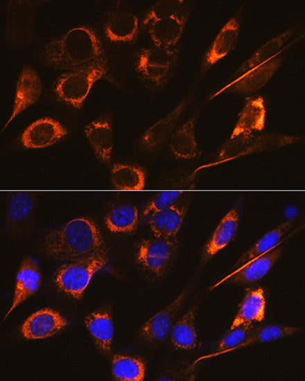 SFRP4 Rabbit mAb
