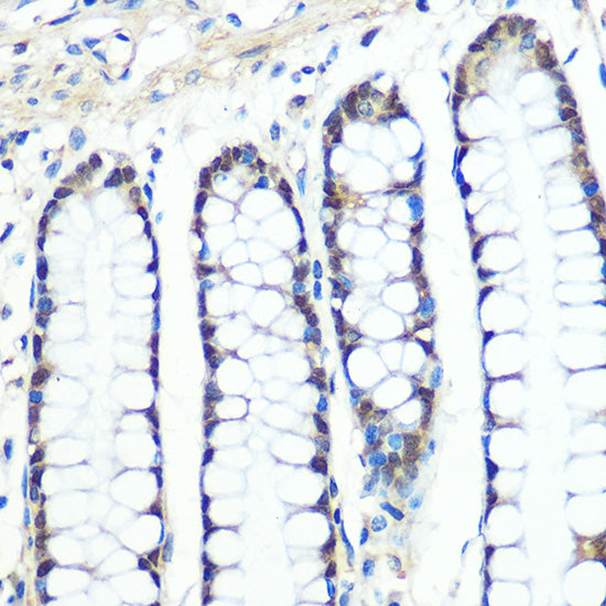 Chk1 Rabbit mAb