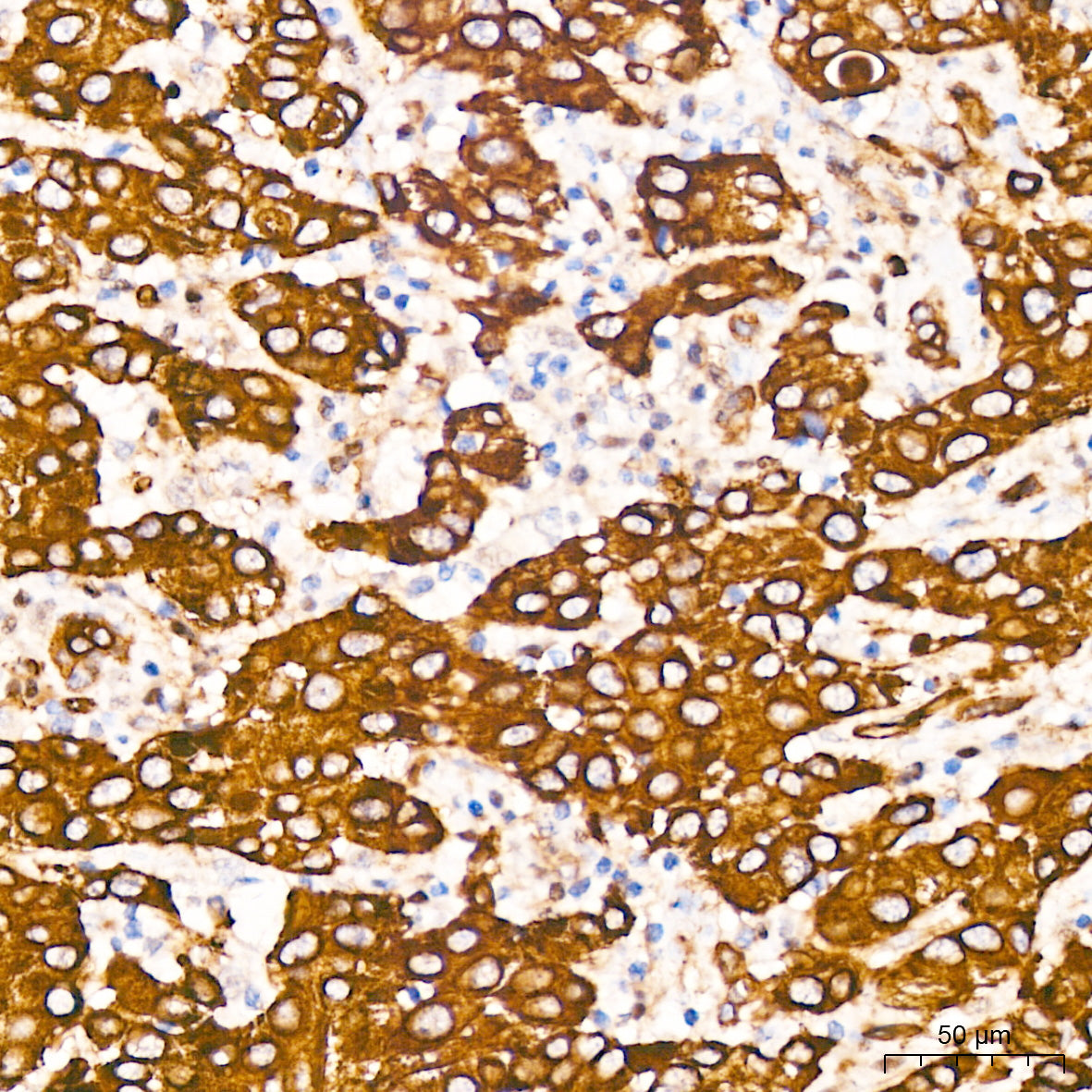 Aquaporin-1 (AQP1) Rabbit mAb