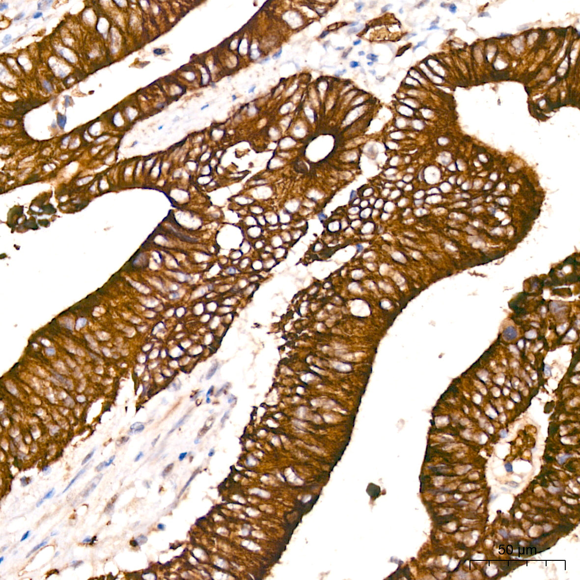 Aquaporin-1 (AQP1) Rabbit mAb