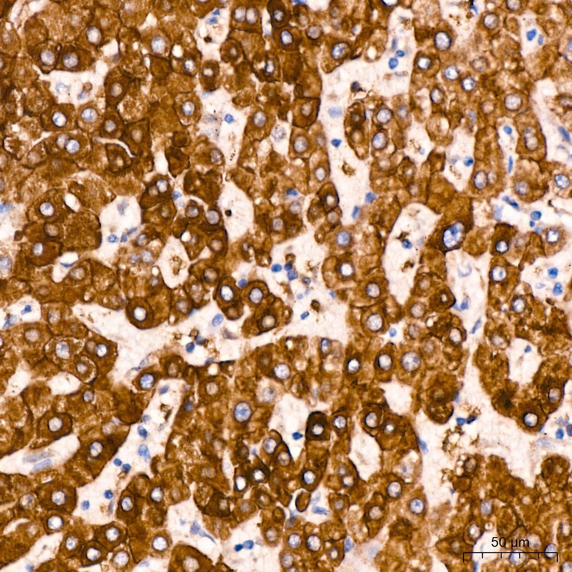 Aquaporin-1 (AQP1) Rabbit mAb