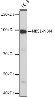 NBS1/NBN Rabbit mAb
