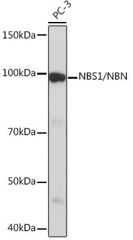 NBS1/NBN Rabbit mAb