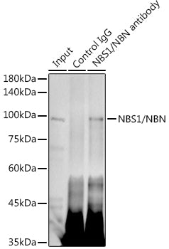 NBS1/NBN Rabbit mAb