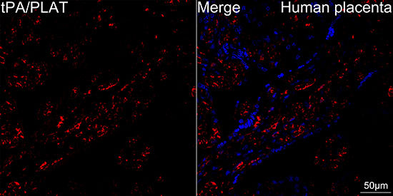 tPA/PLAT Rabbit mAb
