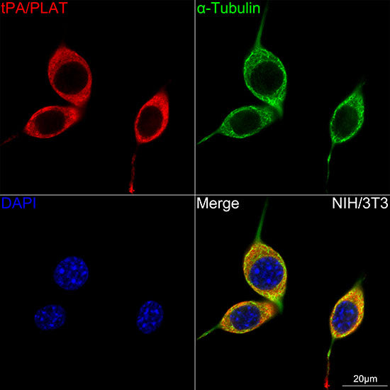 tPA/PLAT Rabbit mAb