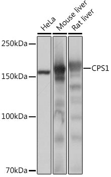 CPS1 Rabbit mAb