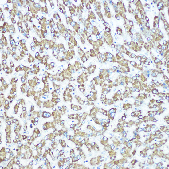 CPS1 Rabbit mAb