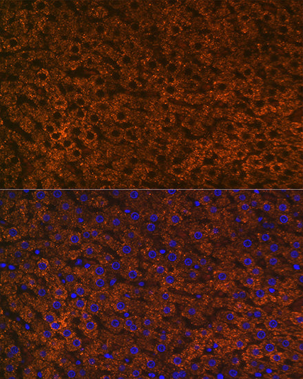 CPS1 Rabbit mAb