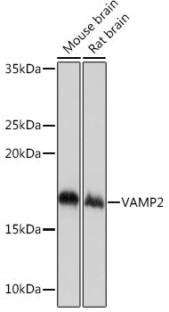 VAMP2 Rabbit mAb
