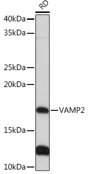 VAMP2 Rabbit mAb