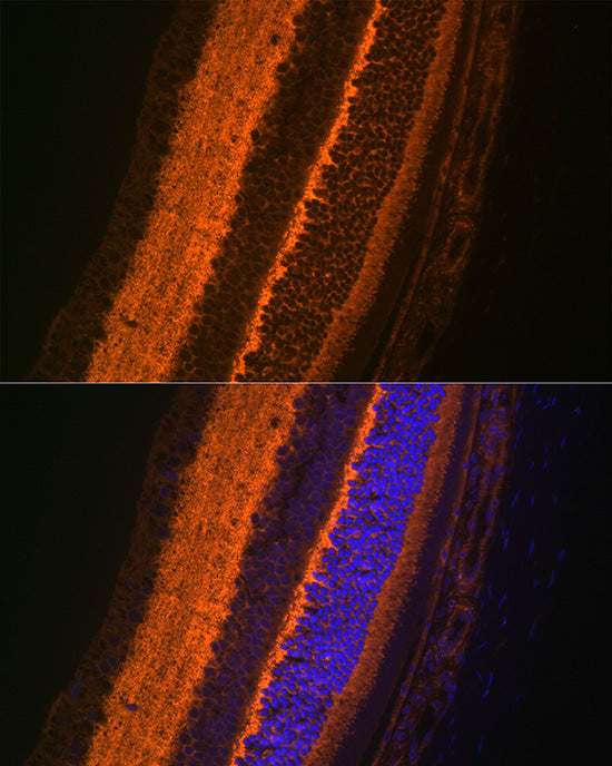 VAMP2 Rabbit mAb