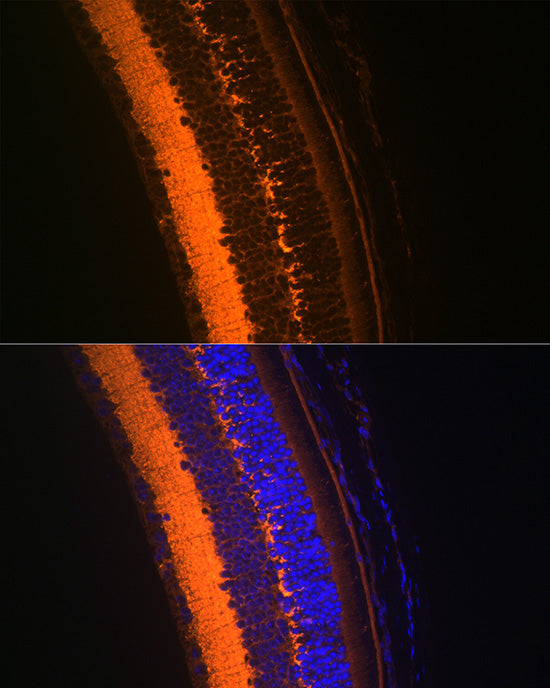 VAMP2 Rabbit mAb