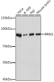 RRM1 Rabbit mAb