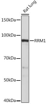 RRM1 Rabbit mAb