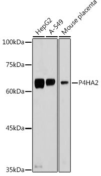 P4HA2 Rabbit pAb