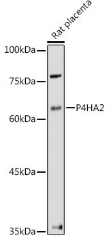 P4HA2 Rabbit pAb