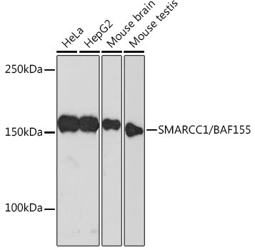 [KO Validated] SMARCC1/BAF155 Rabbit mAb