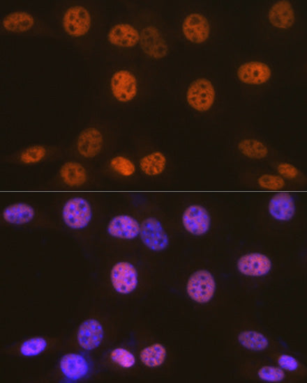 [KO Validated] SMARCC1/BAF155 Rabbit mAb
