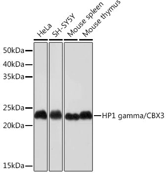 HP1 gamma/CBX3 Rabbit mAb
