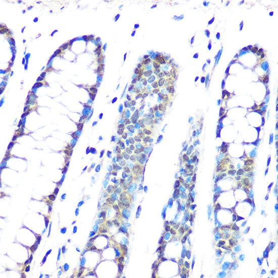 HP1 gamma/CBX3 Rabbit mAb